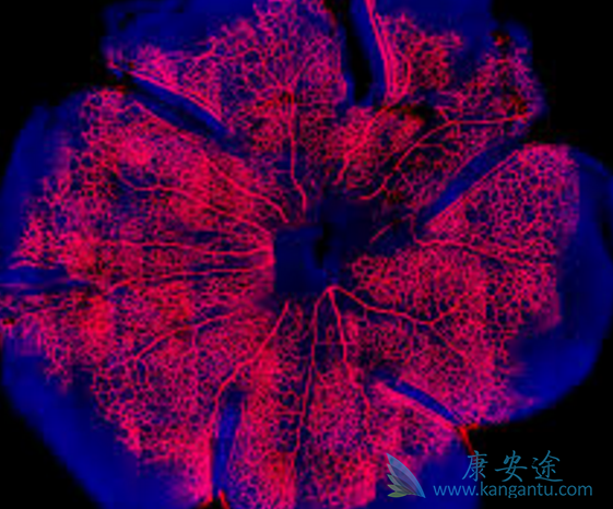 �����׷�