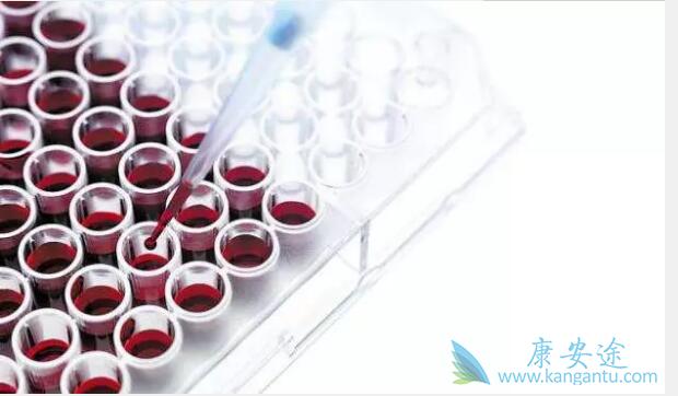 �Ҹα��濹ԭ����