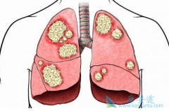 ��������/���޿���δEGFRδѡ��ķΰ������е�����Ч������