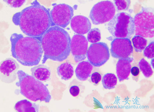 伯舒替尼 伯舒替尼