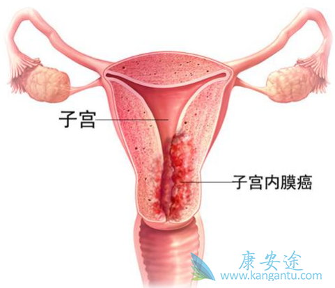 阿瓦斯汀 阿瓦斯汀