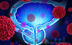 ��������(Abiraterone)��ͨ���ļ�����������ǰ���ٰ���