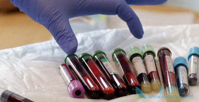 CAR-Tϸ���Ʒ�