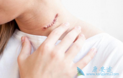 ������ܰ������߶���ķ����(pembrolizumab)��ʾ�����������Ӧ