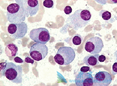 ���䵥��(Opdivo)���ƶ෢�Թ��������ٴ���������������������