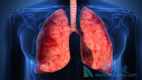 �ΰ�����