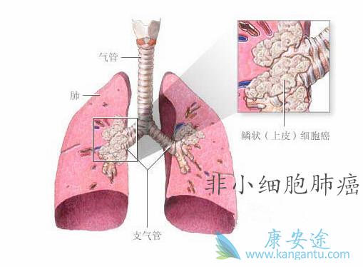 ��Сϸ���ΰ�