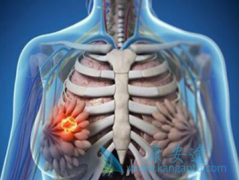 ��������(VOTRIENT)������ɼ�������������ٰ��ﵽ�������Ʊ�׼����