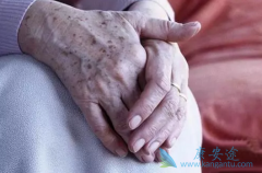 Ƥ����֢������֢״����Ϊ���ֲ�����ɫ�����ڰ�