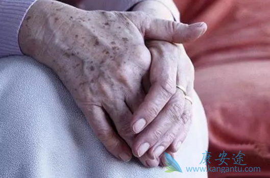 Ƥ����֢������֢״