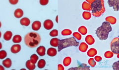 �������ʸ�����/�������ὺ�ҵĻ��߿ɽ�ҩ���ɢ��ƻ��֭��