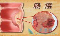 ��������(xeloda)Ϊ���������ṩ��һ����Ч����ȫ��ά�����Ʒ���