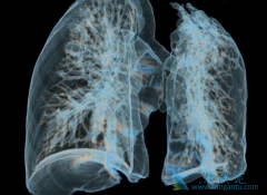 AURA17�о�ǿ��������֤��̩��ɳ(Tagrisso)���й��ΰ������е���Ч��