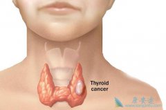 ����ҽ�Ƹ������״�ٰ�֢״���ֵ�������ʲô��