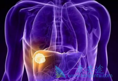 �ΰ�������