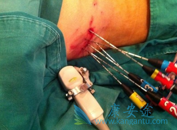 �ΰ�����