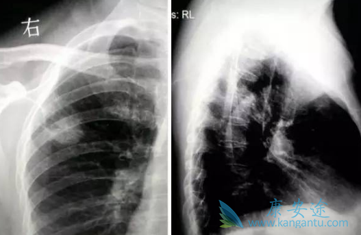 ӡ������ɳ