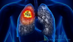��������(ERLOTINIB)Ϊ����EGFR����ͻ���NSCLC���ƴ���ʲô�ı�