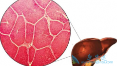 ���ǶȰ�/�����׵õ�ҩ�����������ڸΰ������Ӧ�����и��ߵķ�Ӧ��