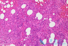 ��������/��ϣ�ɽ���������Գ���CML�����и��ߵ�MMR��