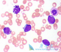 ��������(Nilotinib)���ƶ�ͯ������Ѫ��������230mg