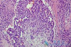 �����鵥��/̩������������GBM��ʾ�����õİ�ȫ�Ժ�������