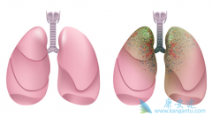 ̩����/�����鵥������Ҫ�������ڶ�Ƥ���Ĳ�����ӦС