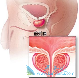 阿比特龙 阿比特龙
