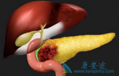 ���������޿�/��������Ҳ���������ٰ��Ķ�������ҩ��