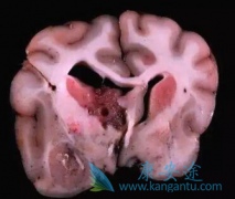 �԰������ڱ��������ʹ�ɳ������������������û�н�һ����ɢ