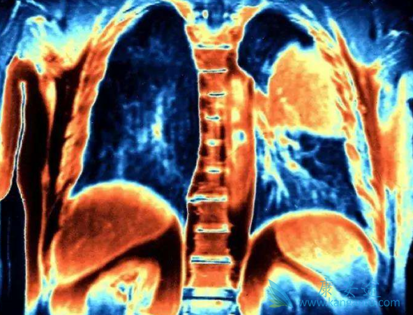 奥希替尼 奥希替尼