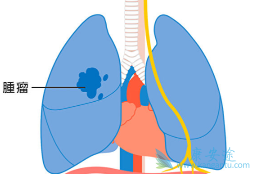奥希替尼 奥希替尼
