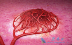 ��������(SORAFENAT)������Ч���ܸ��ײ���Ӱ����