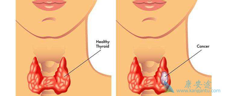 ��״���׿�