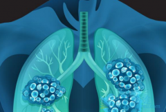 ӡ������ɳ(GEFINAT)����������EGFR����ͻ��ķΰ�������