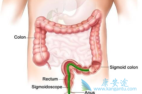 ��ֱ����