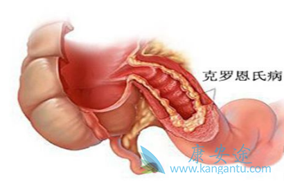 阿达木单抗 阿达木单抗