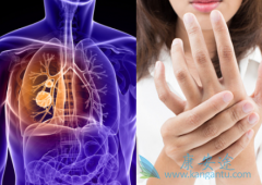 ����ҩ��ӡ�����޿�(GRLONAT)��Ҫ��Ե��������°�����