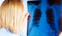 ����ҩ�����޿�(ERLOTINIB)���������õĴ����취