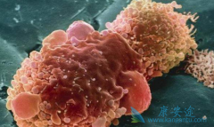 ��������(ERLOTINIB)�����ڼ�ΰ�����Ҫ��Ըߵ���ʳ��