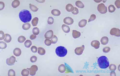 ��������(Imatinib)��ҩ���������Ƹ����þ�Ϊ����ҿɿ���