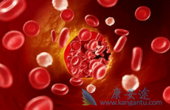 ��������(Bortezomib)�ܰ�ȫ��Ч������������TTP�ĸ�������