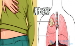 ��ϣ����(OSIMERTINIB)����ҩ��ԭ��ҩһ������ÿƬ80���˺���