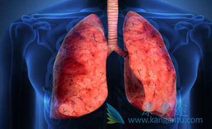 ӡ�����޿�