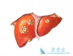 �Ҹ�Я�����粻��ע����仯���ܻᷢչ�ɸ�Ӳ��