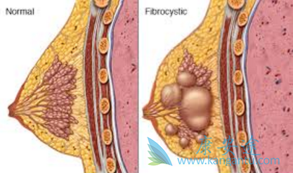 帕博西尼 帕博西尼
