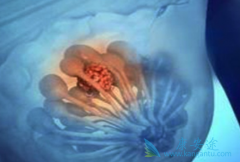 ��������(Palboclib)�����ڷ��ڵֿ��������о޴�Ļ���