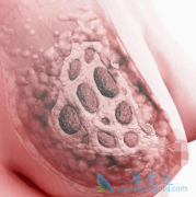 ��������(Ibrance)�����������������ٰ���ҩ��