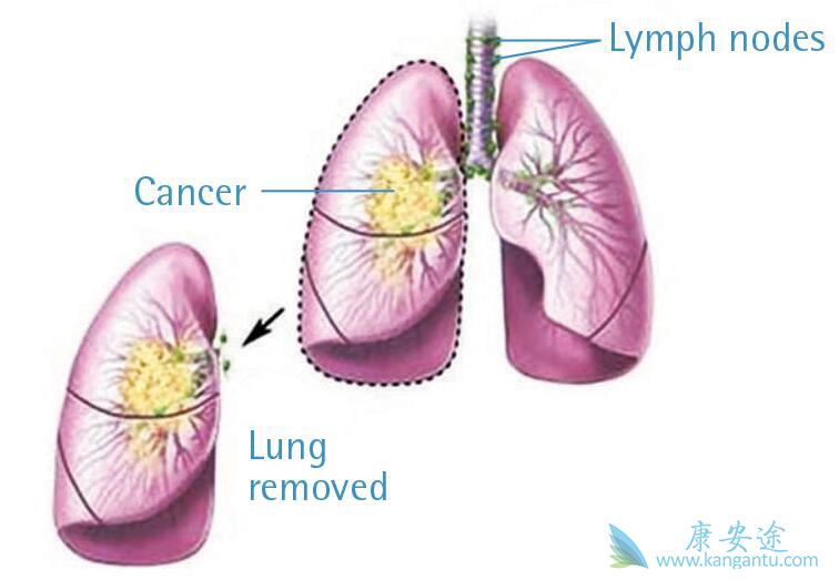 ��Сϸ���ΰ�