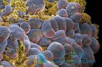 舒尼替尼 舒尼替尼